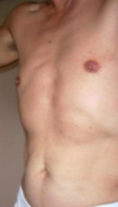 夏バテ防止は普段の運動 画像1