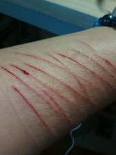 やばかった※画像注意 画像1