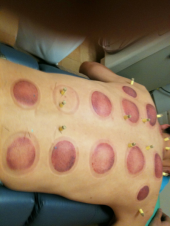 ↑：オケツが大変だ～☆ 画像1