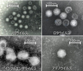ウィルス性胃腸炎＆本格的積雪 画像1