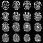 「MRI」 画像1