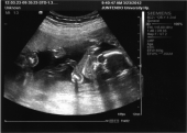 健診日☆スクリーニング検査（20w5d）【きうち】 画像1