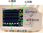 明るい兆しかな・・・。 画像1