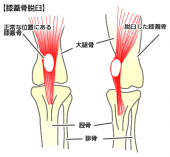 ☆メタボ撃退しましょう!☆ 画像2