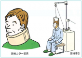 頚椎ヘルニア…。 画像1