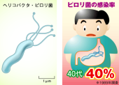 ピロリ菌 画像2