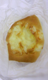 しもやけ悪化・・・ 画像2