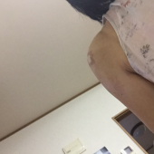 セカンドオピニオン 画像2