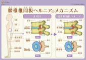 ＭＲＩ 画像1