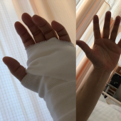 オペ 画像2