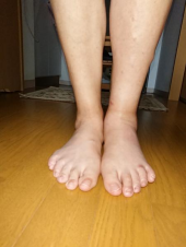足首から下が段々と腫れてきてる(；＿；) 画像1