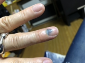 イタタタタ(ToT) 画像2