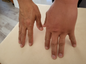 腕がパンパンに 画像1