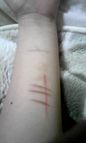 リスカなんでダメなの?…(グロ画?注意) 画像1