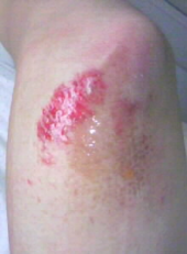 すって~ん! 画像2