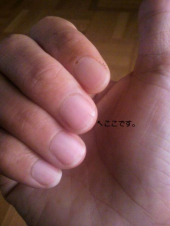つめが・・・ 画像1